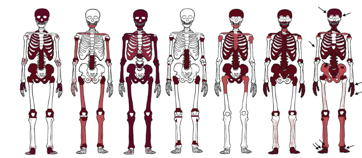 Human Paleobiology and Bioarchaeology 